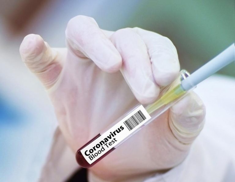Anticorpi naturali vs. anticorpi post vaccinare. De ce testele serologice, puse în discuție în România pentru certificatul verde, au fost respinse în alte țări
